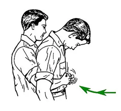1974 the heimlich maneuver for rescuing choking victims is publis 06 01