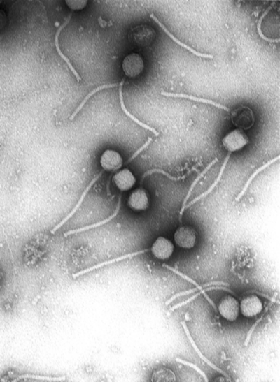1983 a team of researchers led by french virologist luc montagnie 05 20