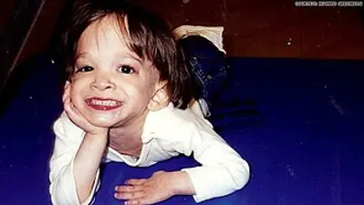 2013 brooke greenberg american girl with a rare genetic disorder 10 24